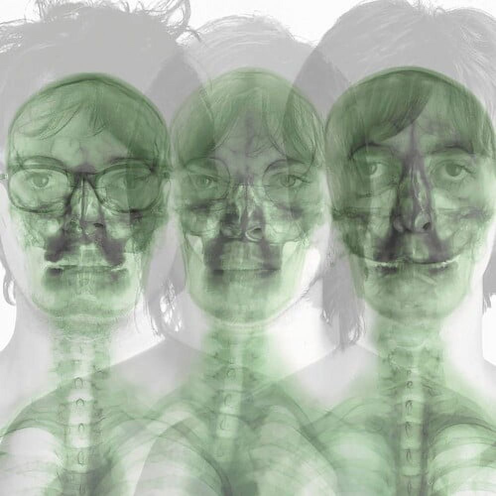 Supergrass: Supergrass (X-Ray Album): Neon Orange Vinyl LP - Steadfast Records