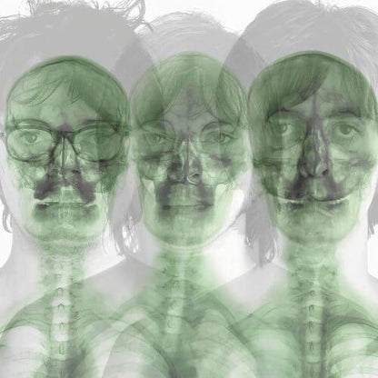 Supergrass: Supergrass (X-Ray Album): Neon Orange Vinyl LP